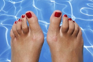 Athlete&#039;s Foot in Swimmers